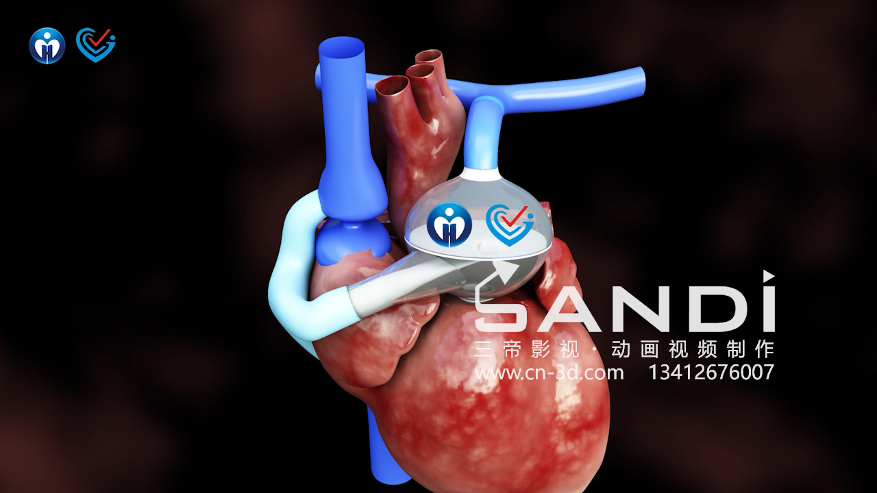 人工心脏3D动画视频